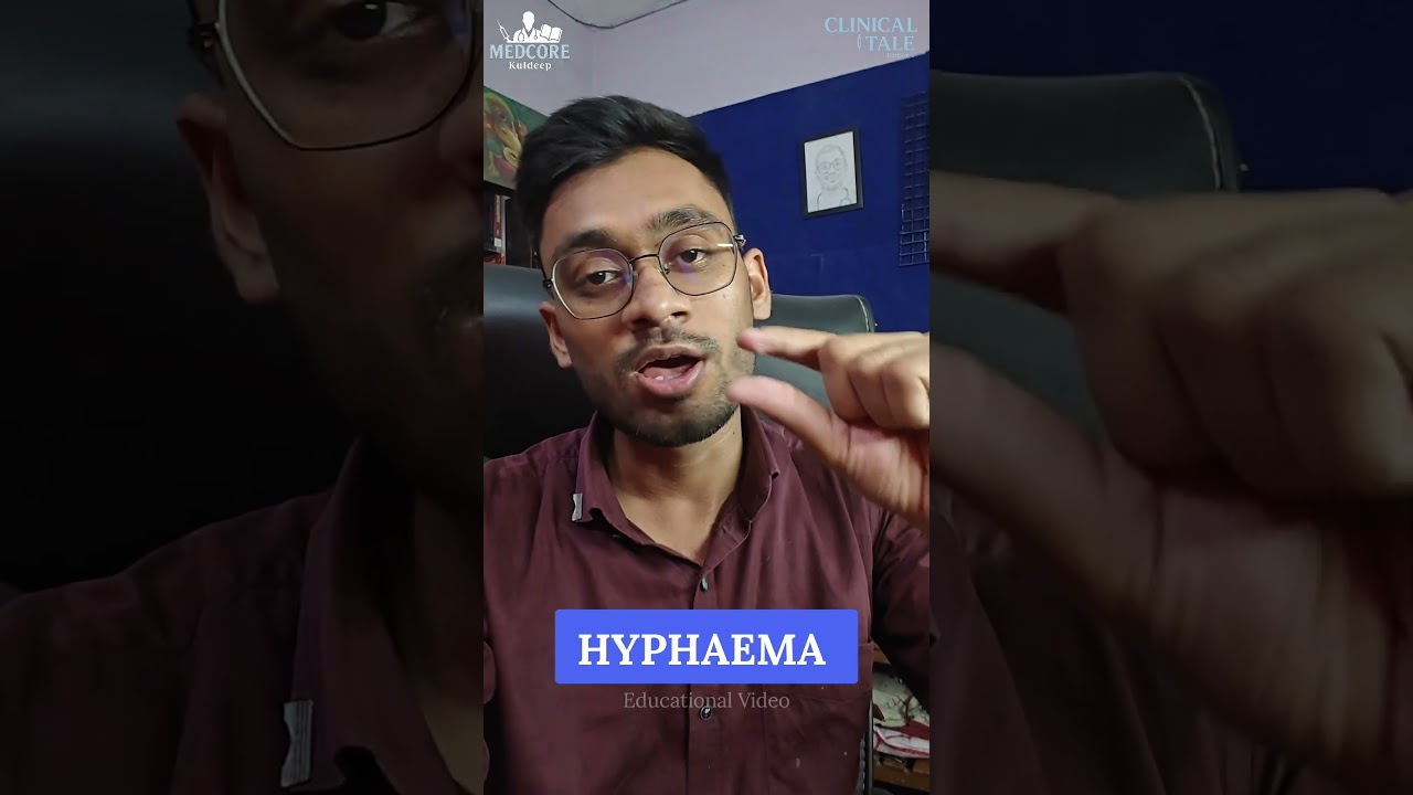 Clinical Tale 06/365 Hyphaema - Eye Trauma in OPD #shorts #youtubeshorts