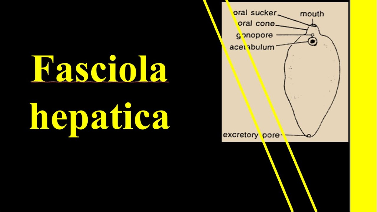 Fasciola hepatica | Liver fluke