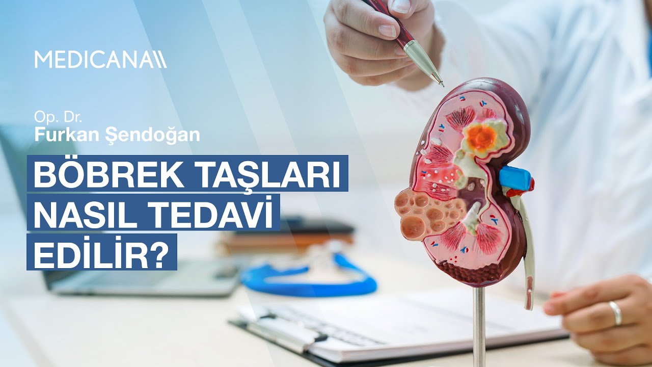 Böbrek Taşları Nasıl Tedavi Edilir? | Op. Dr. Furkan Şendoğan