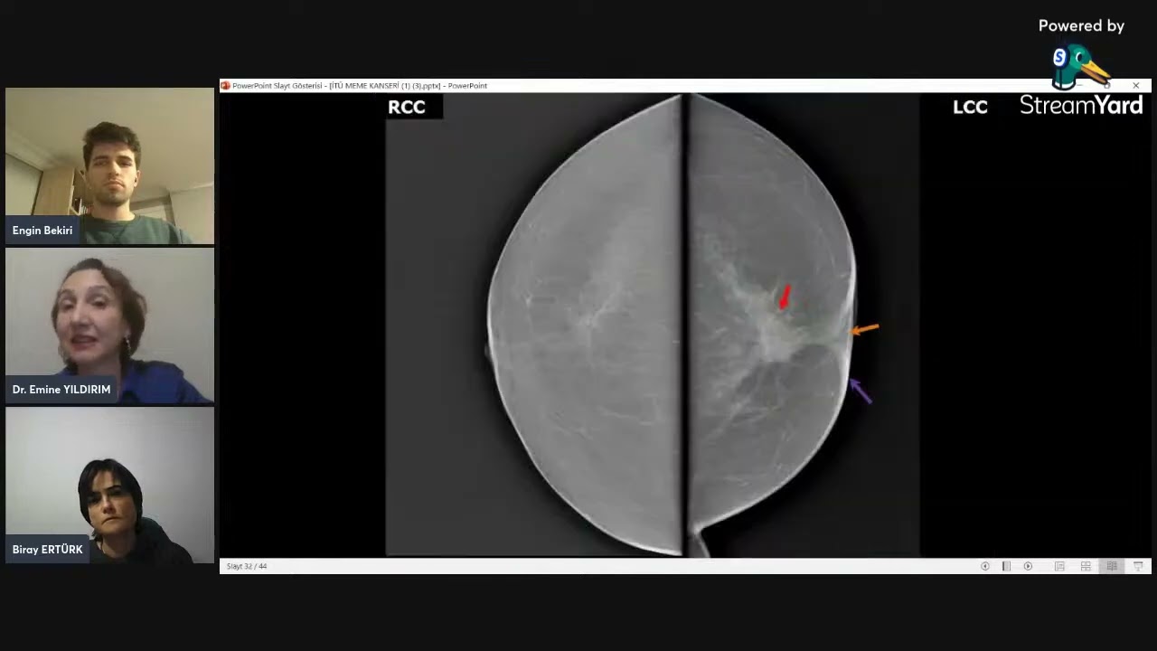 ITU Journal Talks   Doç  Dr  Emine Yıldırım, Uzm  Dr  Biray Ertürk   Meme Kanseri Farkındalık Ayı 1