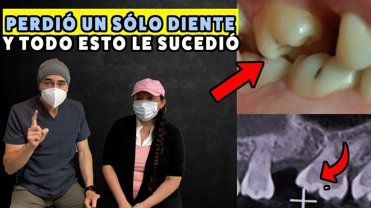 A Jessica le quitaron un diente y comenzó con síntomas que le cambiaron la vida. Testimonio
