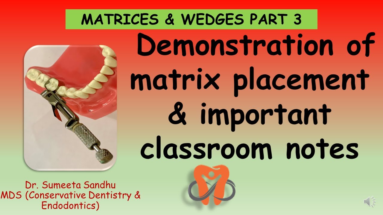 Tofflemire matrix placement| Matrices & Wedges - Part 3