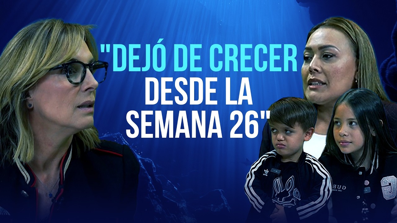 ¿Por qué si son mellizos, uno de estos hermanos tiene acondroplasia?