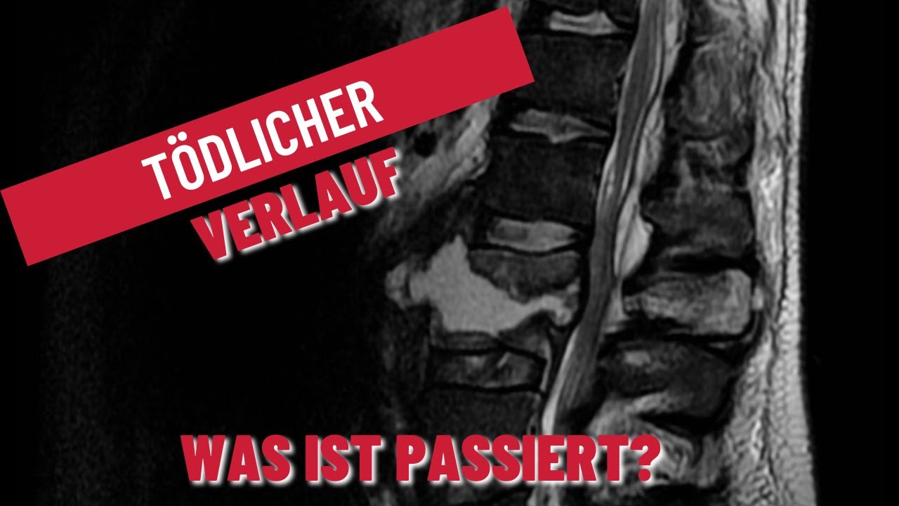 Tod nach Diagnose - Fälle aus der Klinik #medizin #famulatur #casereport
