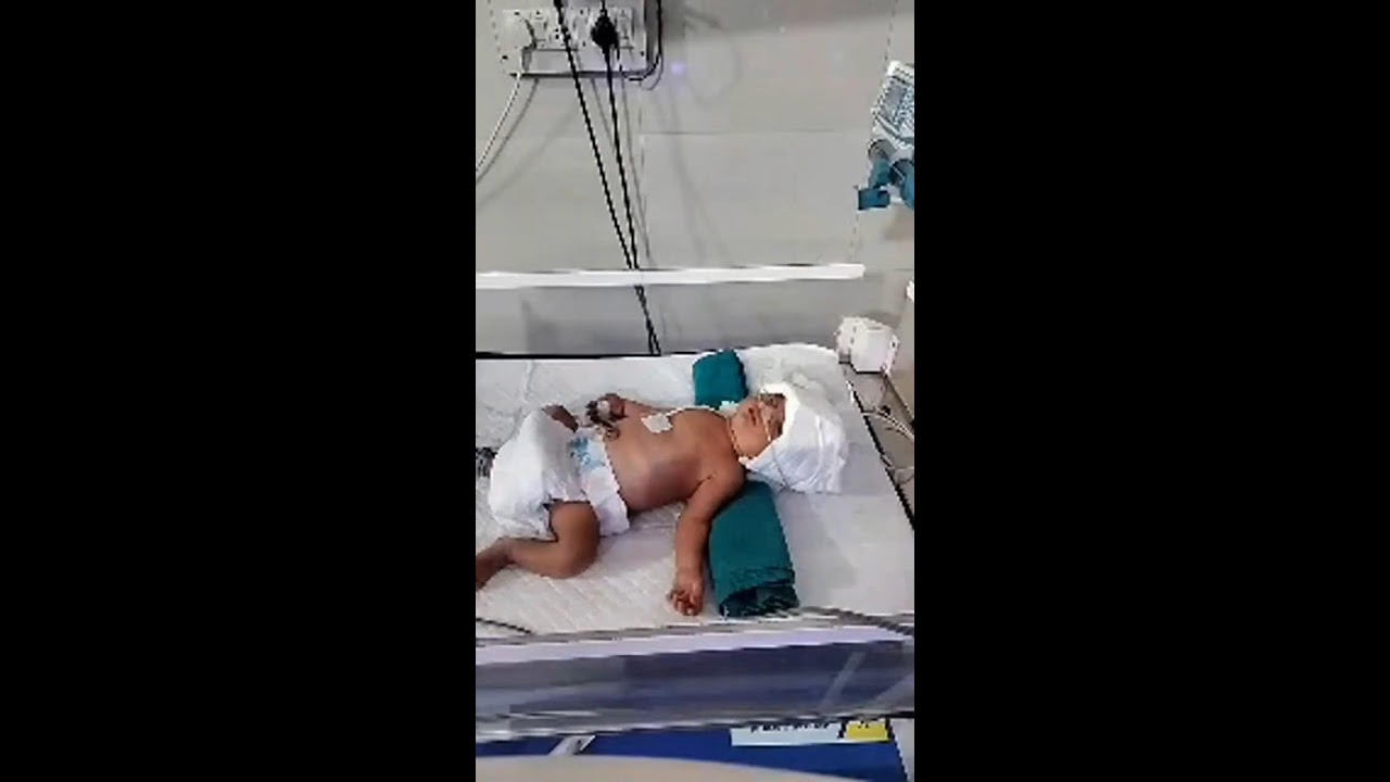 Icu and. Nicu care and treatment in NICU picu NICU