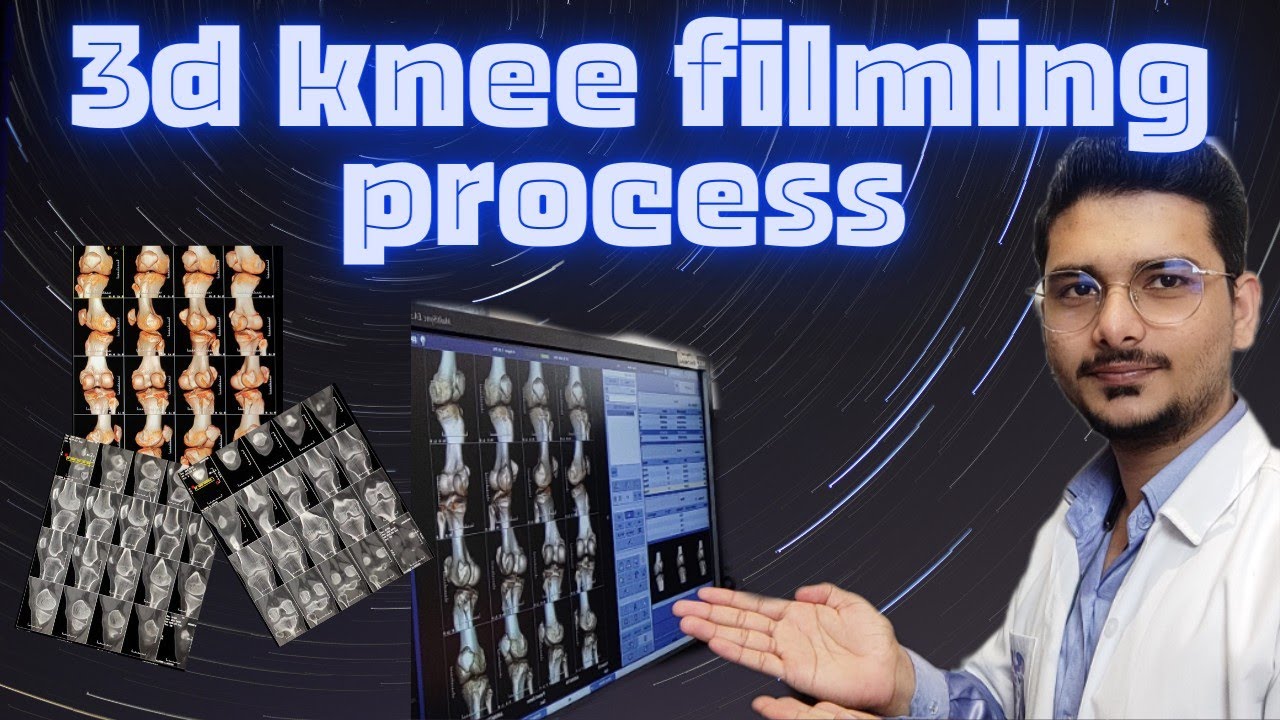 CT Scan 3D Knee filming process | 3D knee filming techniques #ctscan