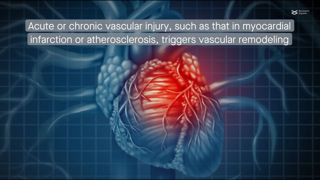 ATP purinergic signaling drives vascular remodeling mediated by Sca-1⁺ stem cells