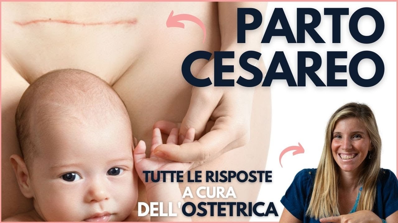 PARTO CESAREO: Guida completa a cura dell'Ostetrica