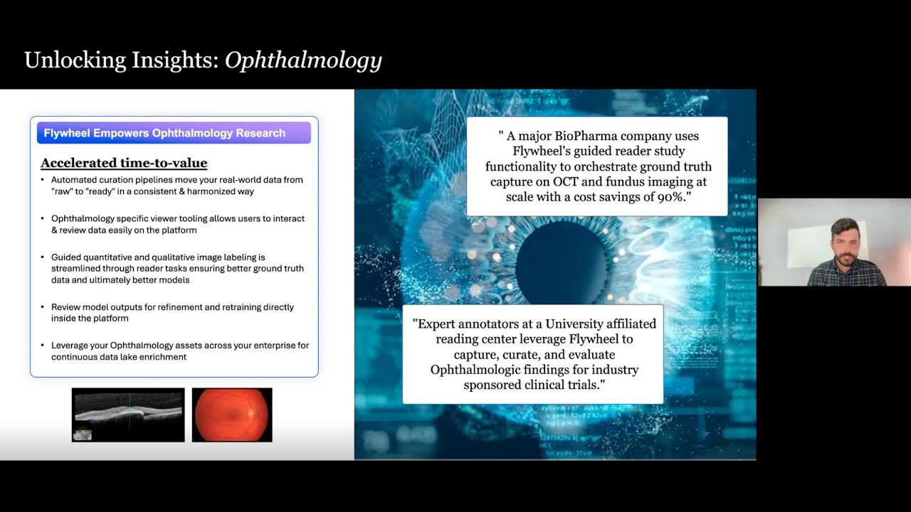 Webinar - Streamline Ophthalmology Imaging Data: Scalable Management & Analysis with Flywheel
