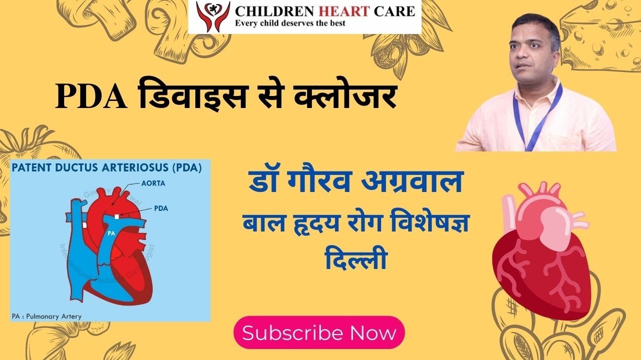 PDA device closure video, PDA, PDA heart defect, pediatric cardiologist 