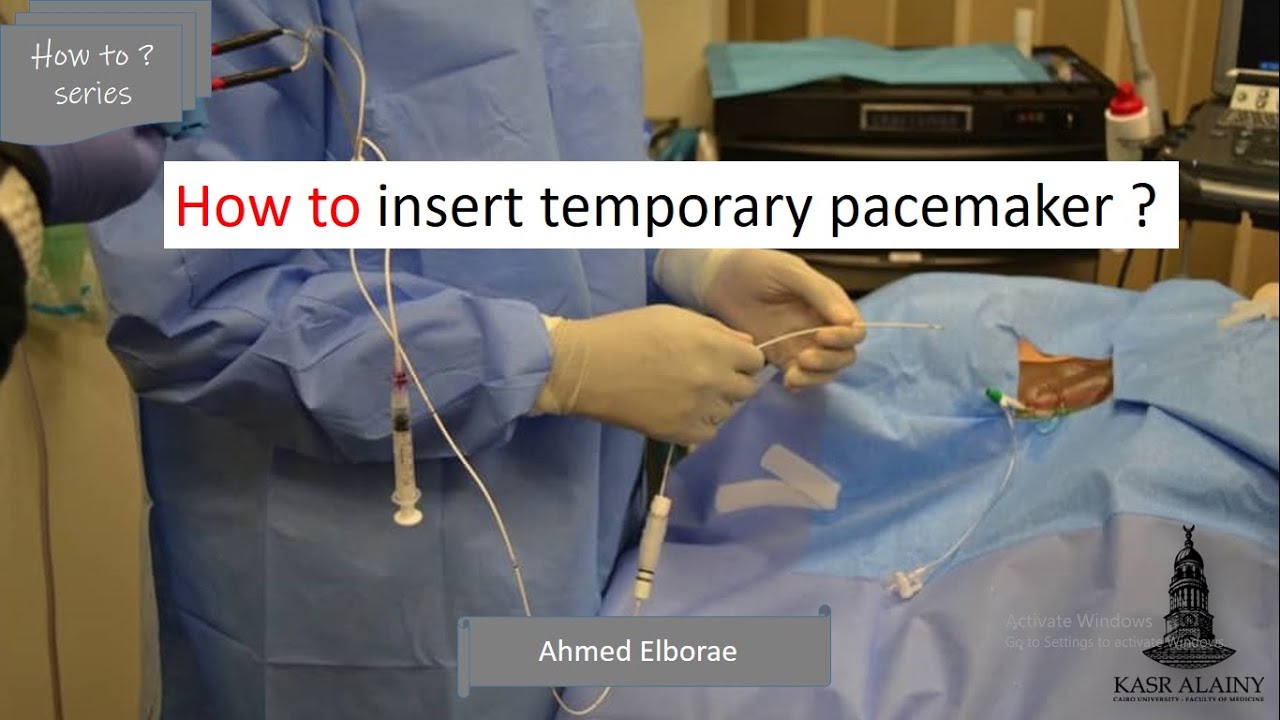 Temporary pacemaker #interventionalcardiology #emergency