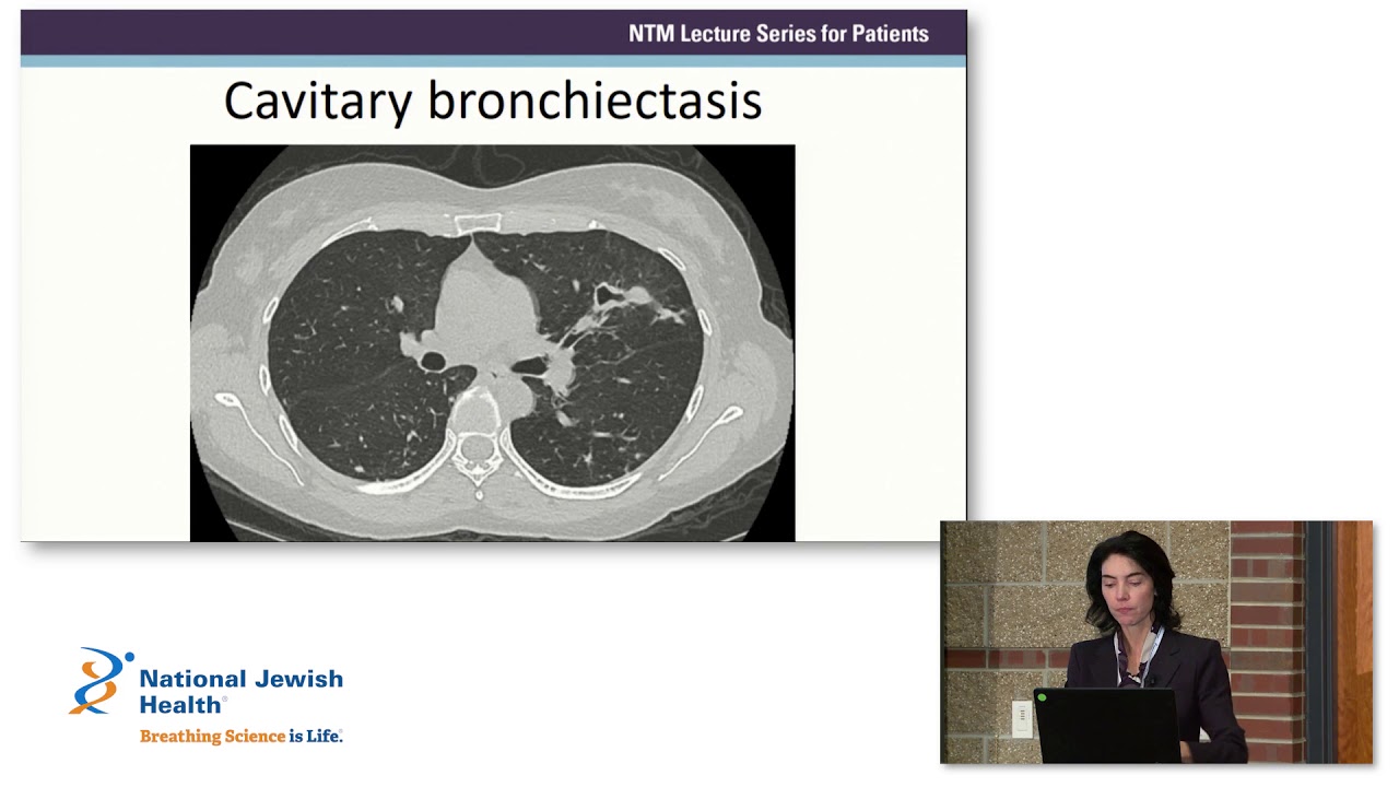 Overview of Nontuberculous Mycobacteria (NTM) and Bronchiectasis