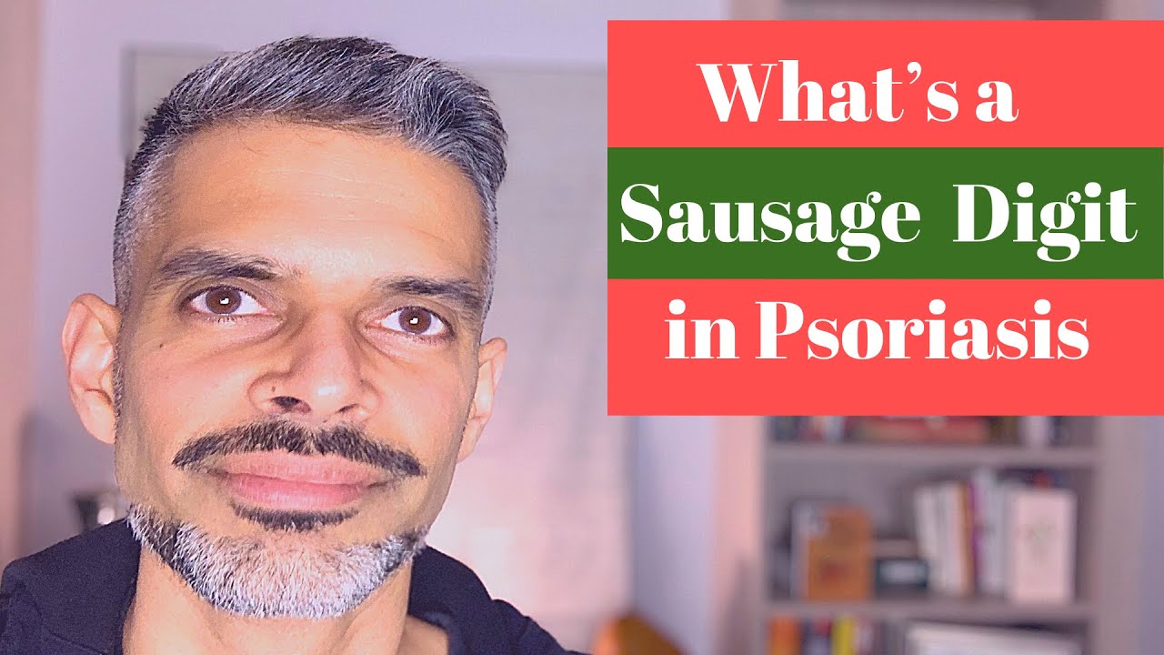 What is a Sausage digit in Psoriasis