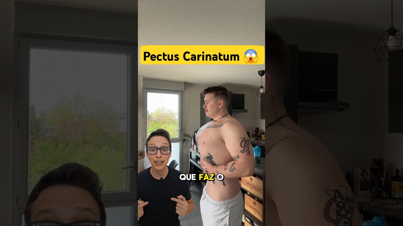 Peitoral 😱 #medicina #medico #enfermagem #enfermeiro #enfermeira Pectus Carinatum - peito de pombo