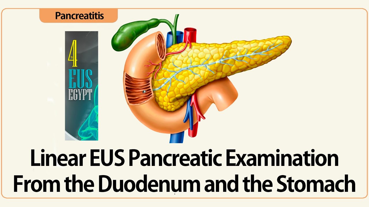 4th EUS Egypt - Linear EUS Examination of the Pancreas From the Duodenum