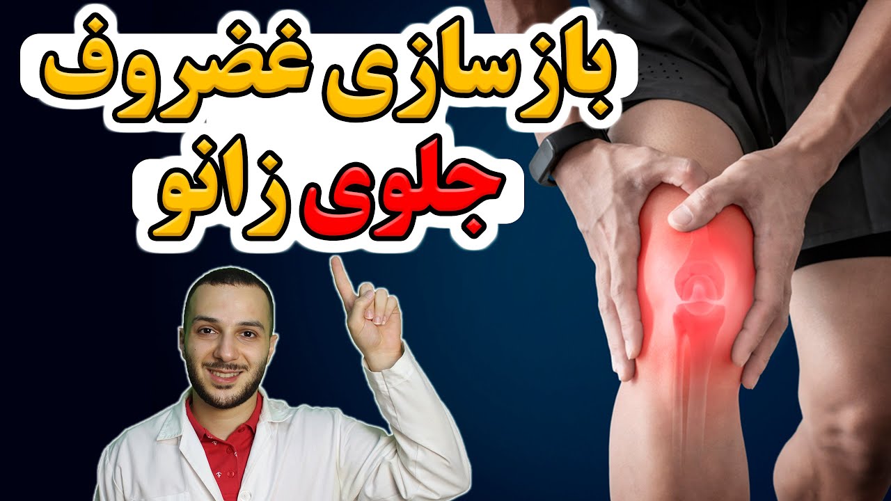 چطور نرمی غضروف زانوم رو در ۱۰ روز درمان کردم؟! بدون نیاز به پزشک