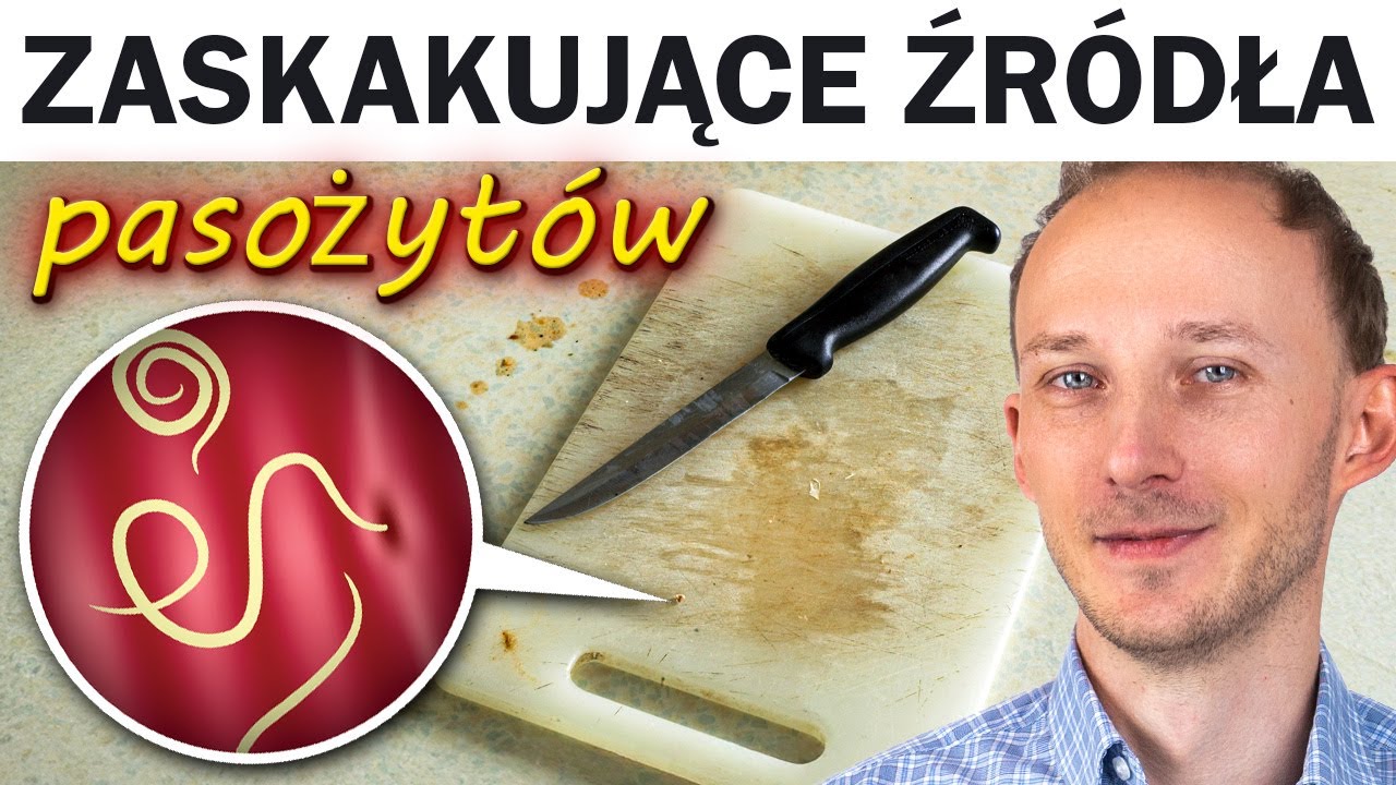 Tak ludzie łapią PASOŻYTY. Objawy i jak je zwalczyć