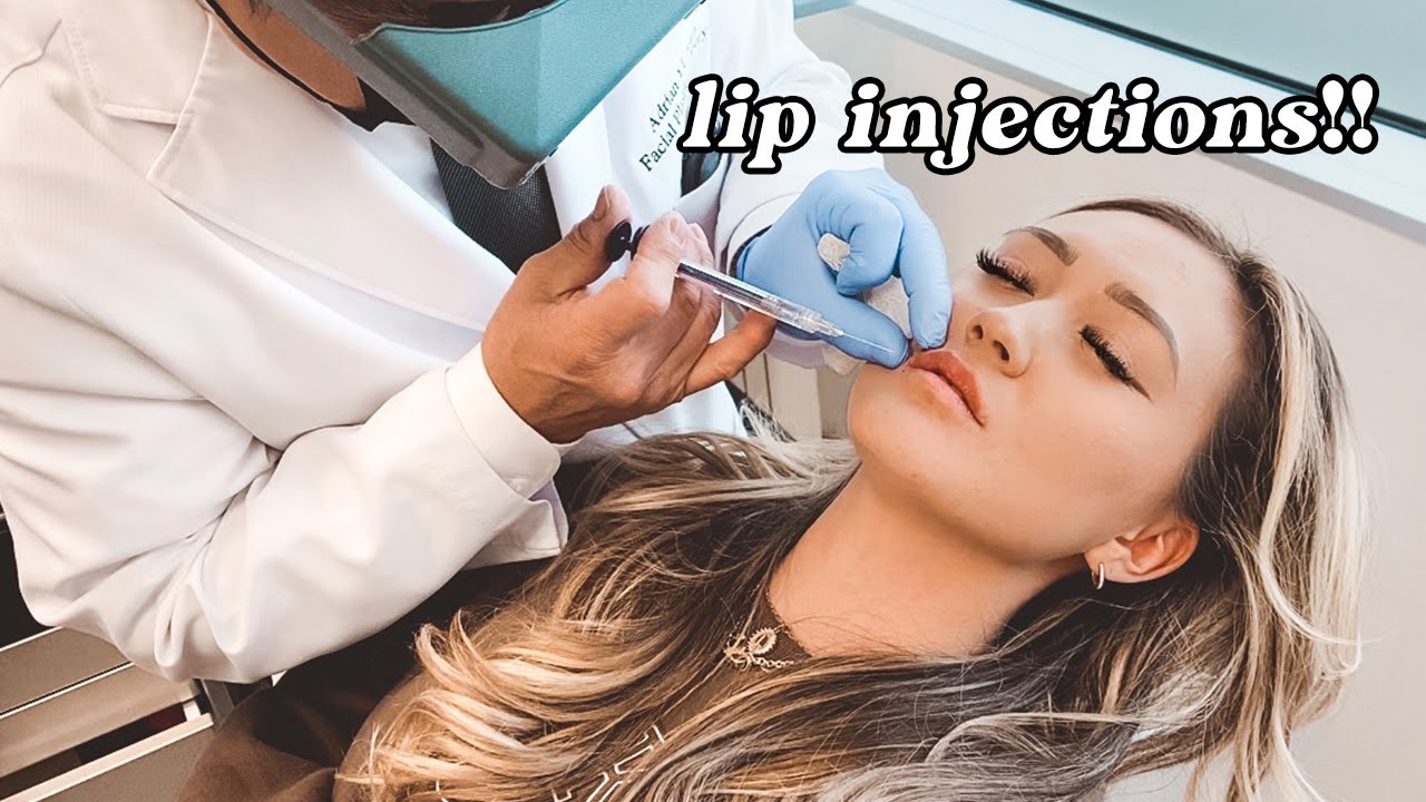 I Got Lip Injections! Experience and Before & After