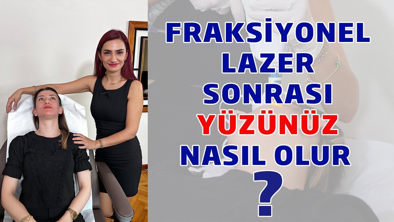 Fraksiyonel Lazer Sonrası Yüzünüz Nasıl Olur ?
