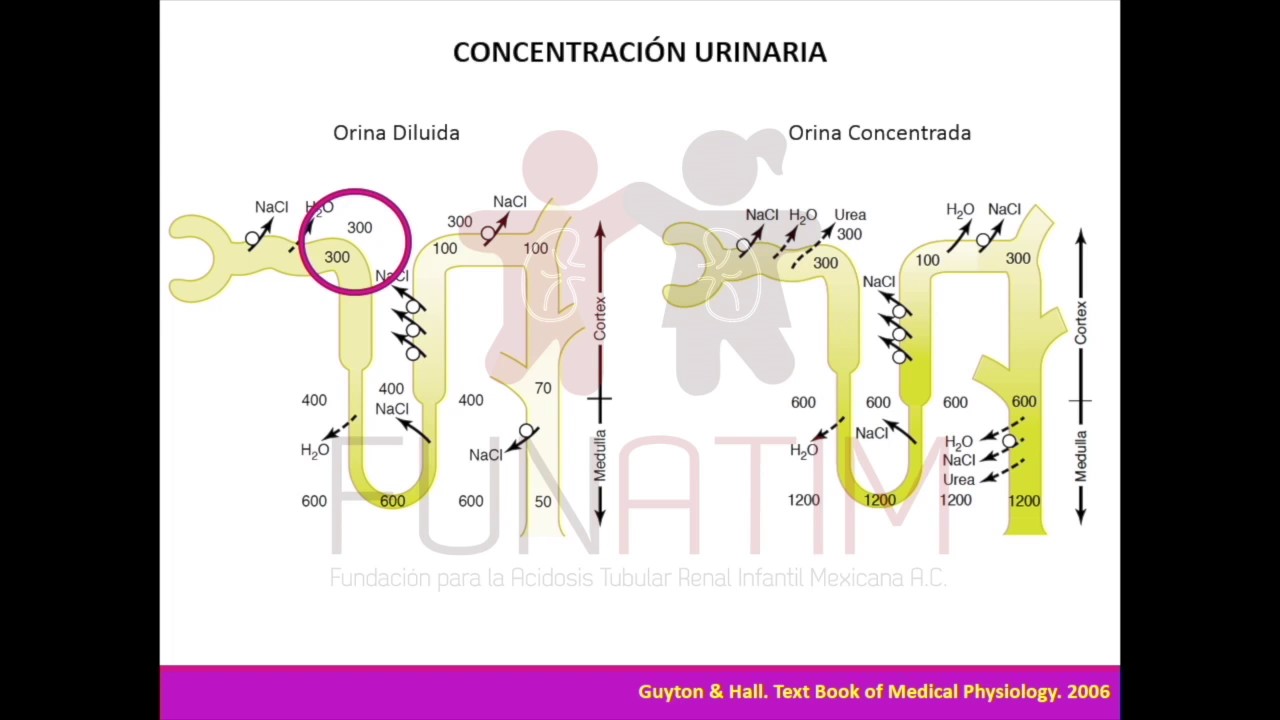 Síndrome de secreción inadecuada de hormona antidiurética (SIADH)