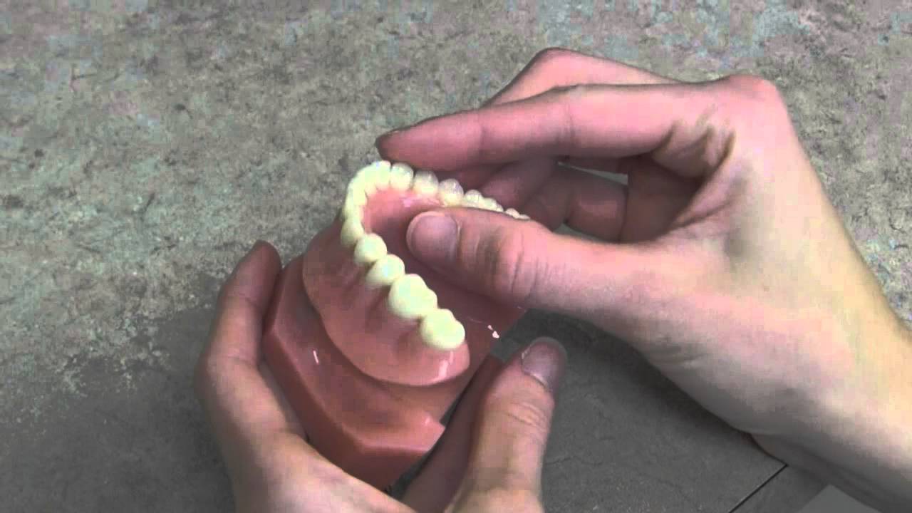 What can I do if my lower denture doesn't fit or keeps slipping?