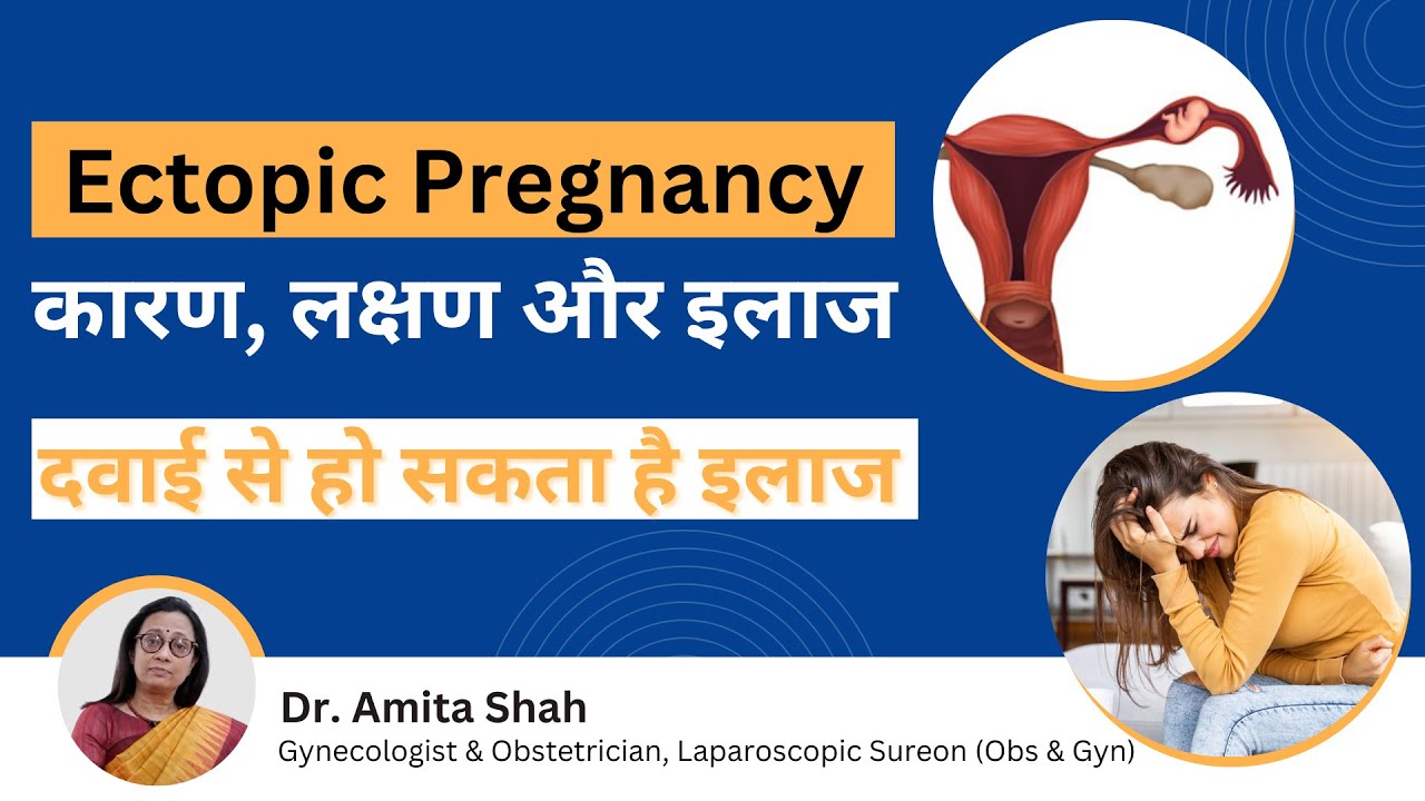 Ectopic Pregnancy | एक्टोपिक प्रेगनेंसी क्या है लक्षण और कारण | Ectopic Pregnancy hindi