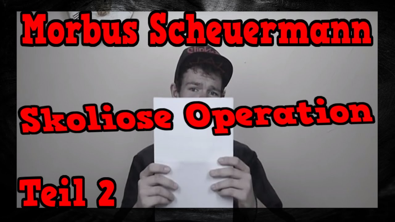 Meine Skoliose bzw. Morbus Scheuermann Operation [Teil 2] [DrissTalk#27]