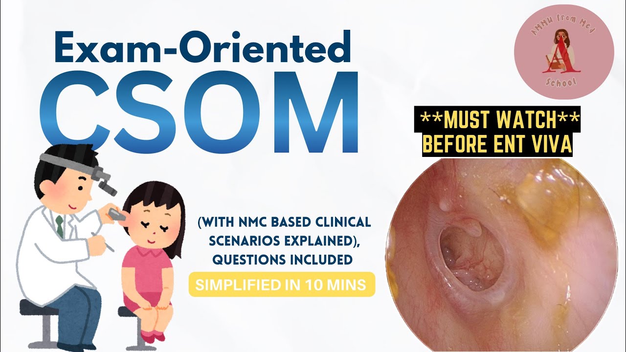 CSOM Made Easy | 15-Min Exam-Oriented Revision for ENT Viva | NMC-Based Clinical Questions Explained