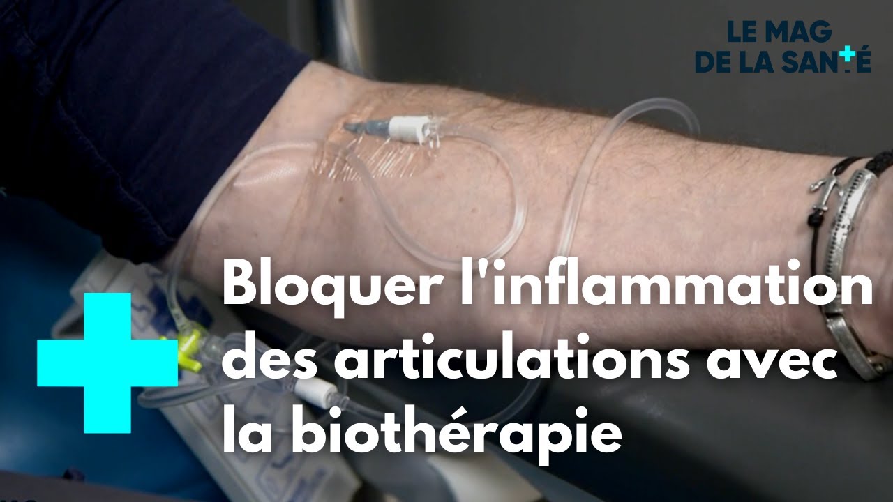 Rhumatismes inflammatoires : une bioth&eacute;rapie qui change la vie - Le Magazine de la Sant&eacute;