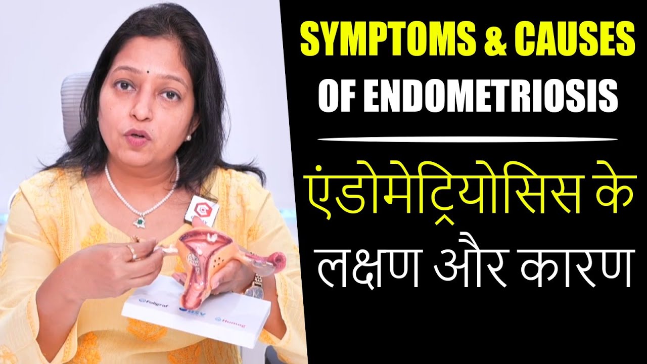 Symptoms & Causes of Endometriosis | एंडोमेट्रियोसिस के लक्षण और कारण | DR. Prachee | Doctors Qube