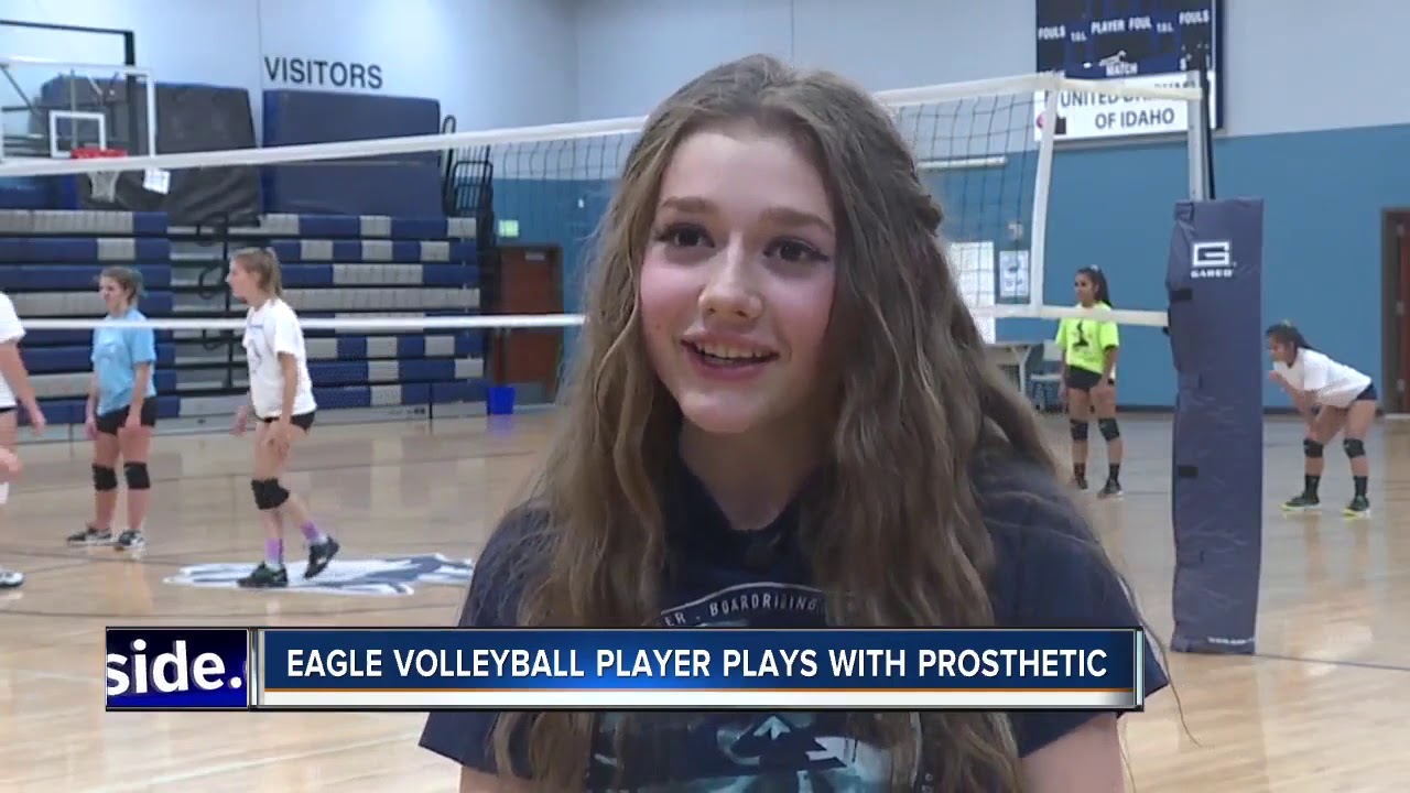 Local volleyball star plays with a prosthetic leg
