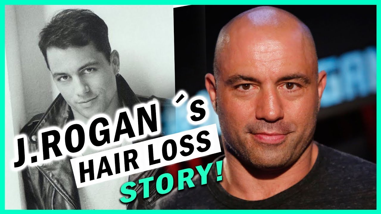 Joe Rogan shaved his head after 3 Hair Transplants! Why!?