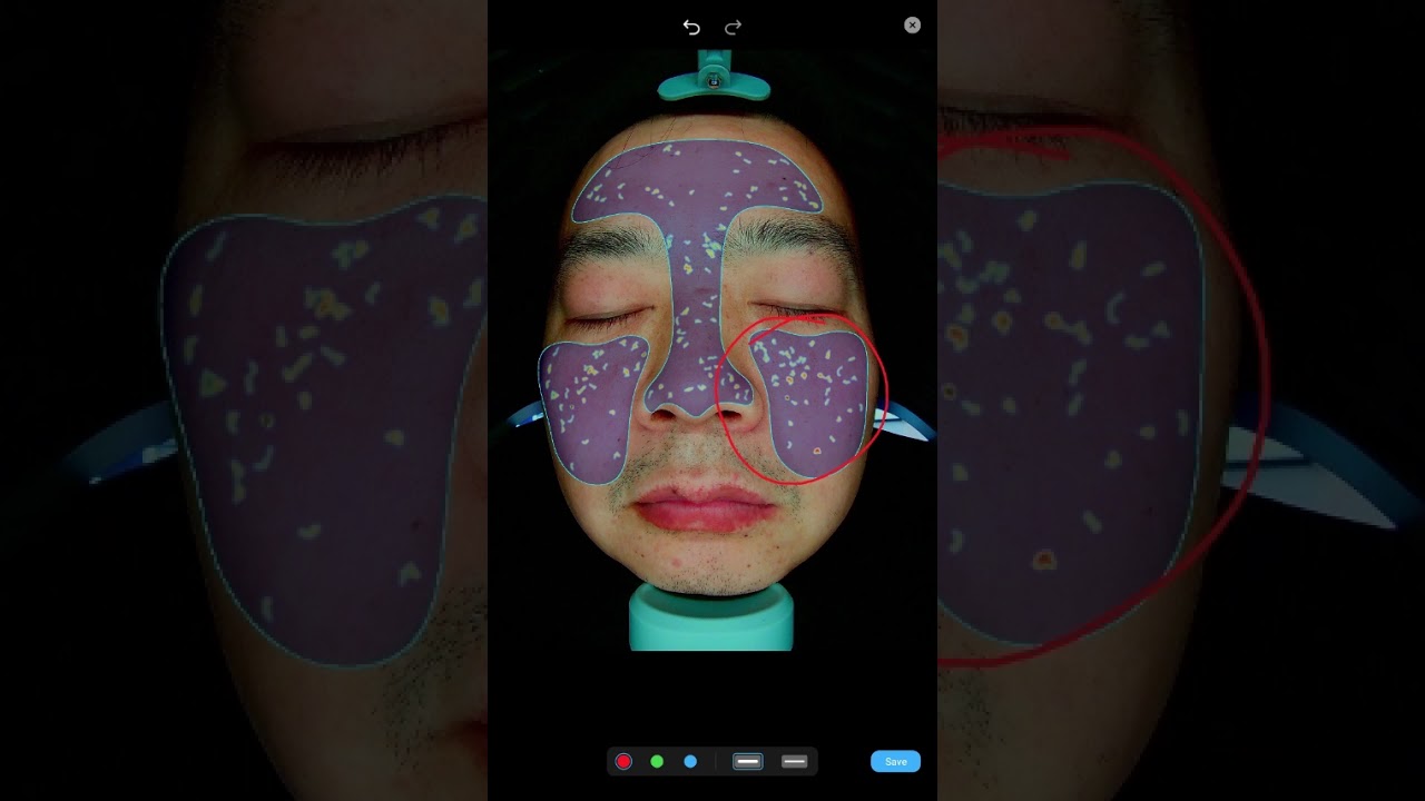 X5 Pro AI Skin & Scalp Analyzer | Full English Tutorial & Operation Guide PS-X5PRO