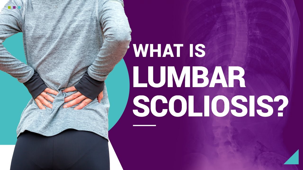 What Is Lumbar Scoliosis?