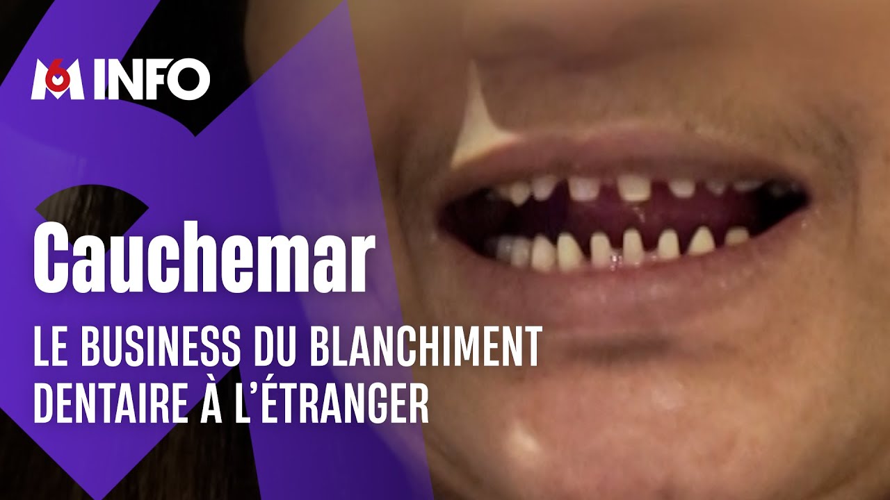 Enquête sur le dangereux business du blanchiment dentaire à bas coût en Turquie