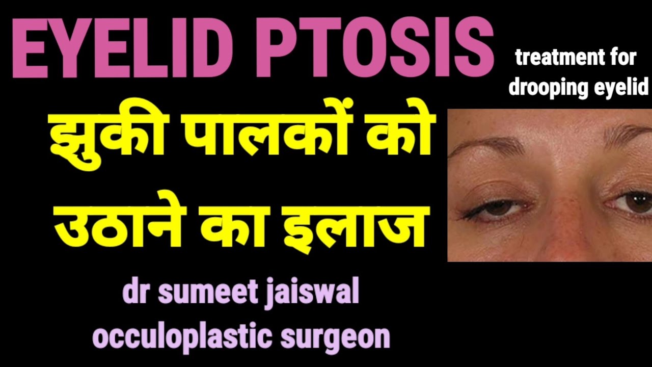 EYELID PTOSIS SURGERY india indore mumbai delhi bhopal nagpur raipur lucknow hyderabad kolkata pune