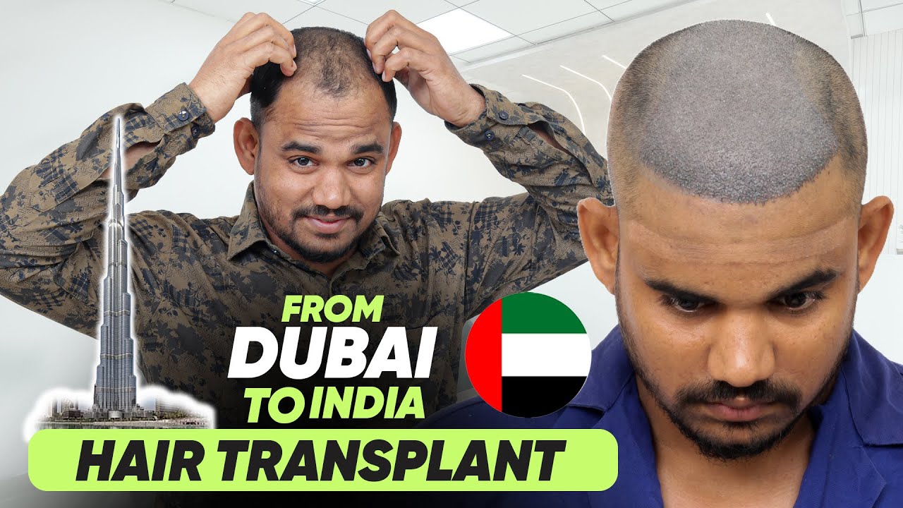 Hair Transplant in Bhopal (HX-HYTT) | Best Results & Cost of Hair Transplant in Bhopal