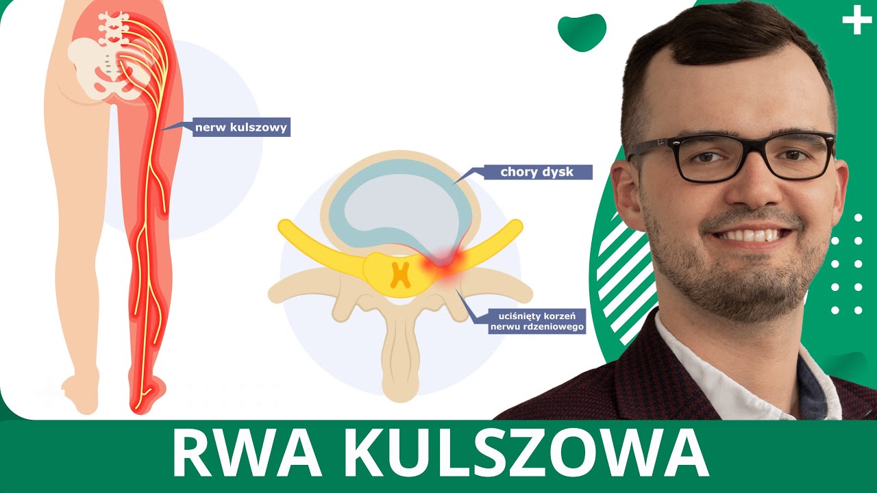 Rwa kulszowa - objawy, przyczyny i leczenie. Jak ją leczyć u os&oacute;b młodych i starszych? Iniekcje