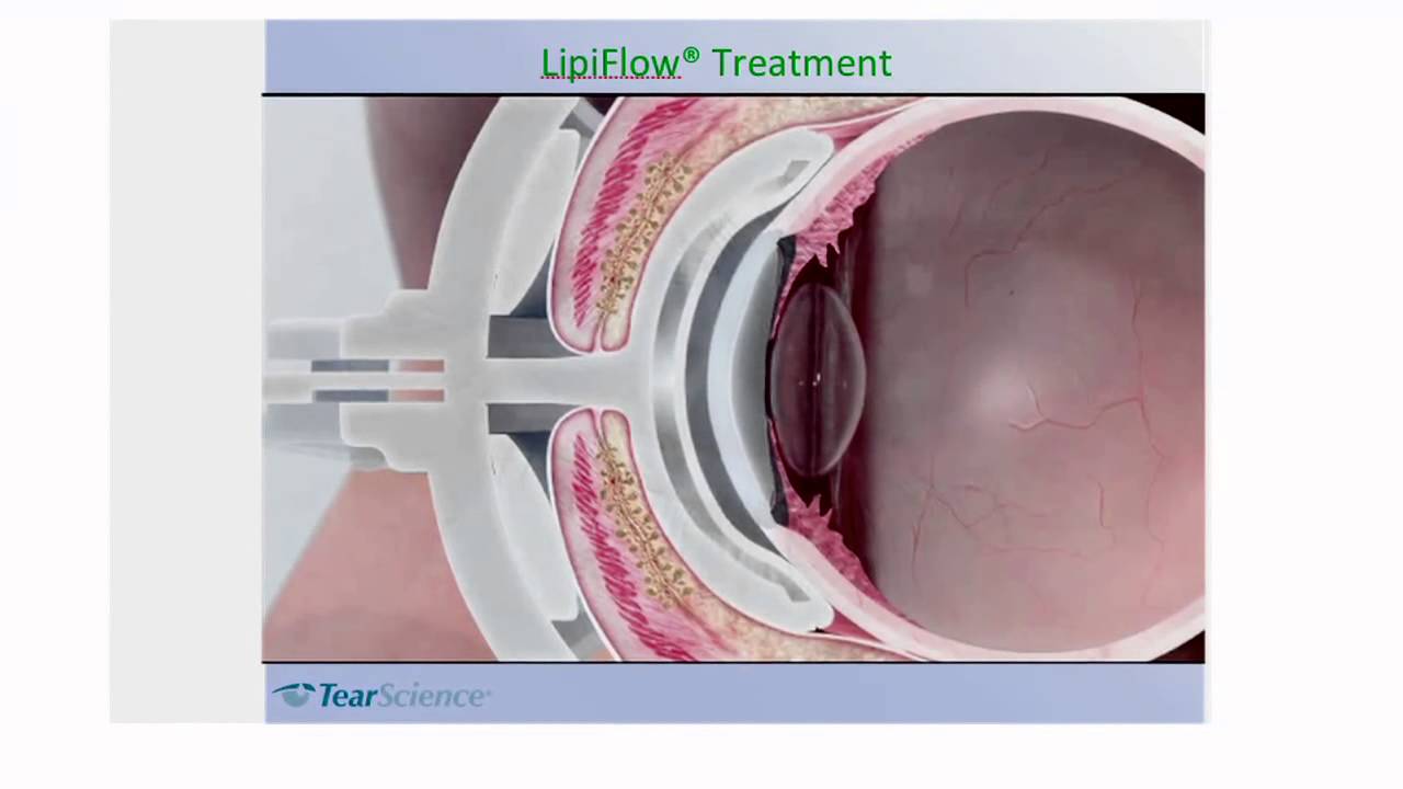 Dr Jaccoma Lipiview Short
