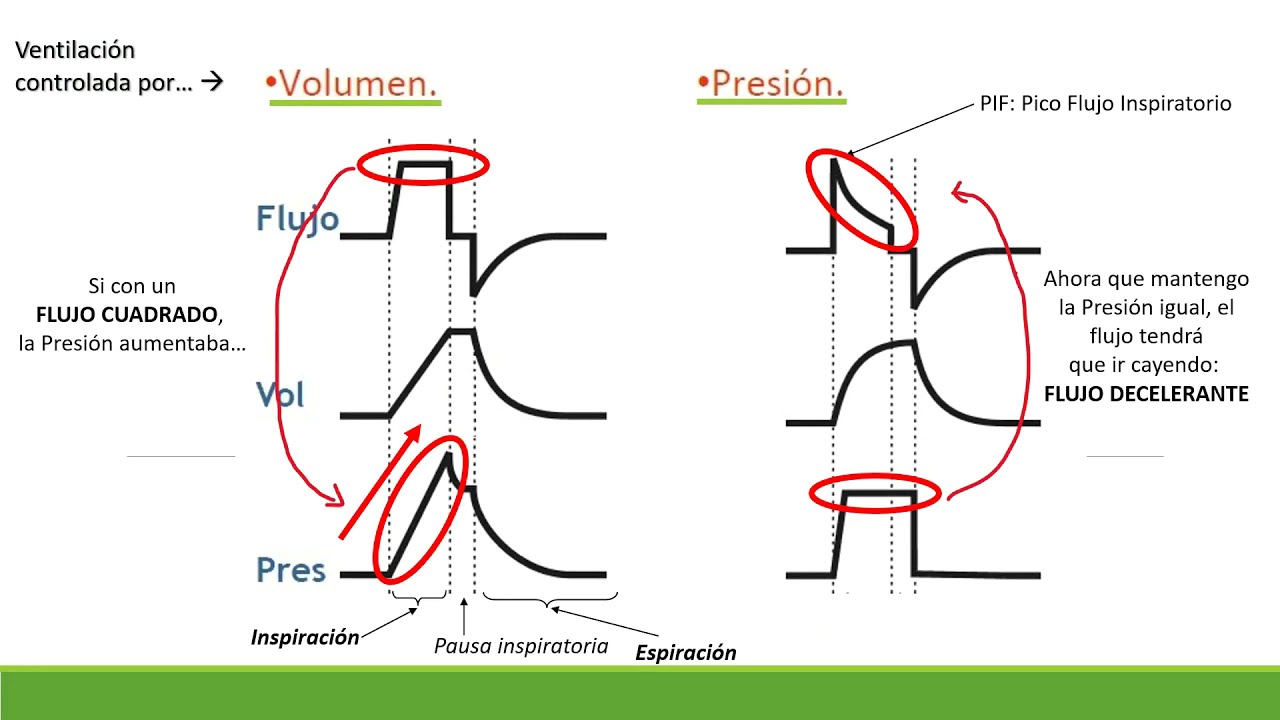Gráficas en ventilación mecánica: VCV, VCP