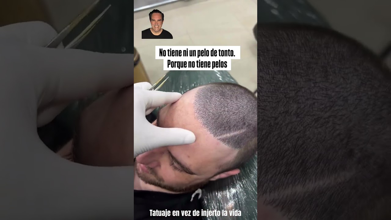 C&oacute;mo puedo disimular la calvicie. Si tienes c&aacute;lmalo sin tatuaje.Tatuaje de pelo ,alopecia #caidapelo