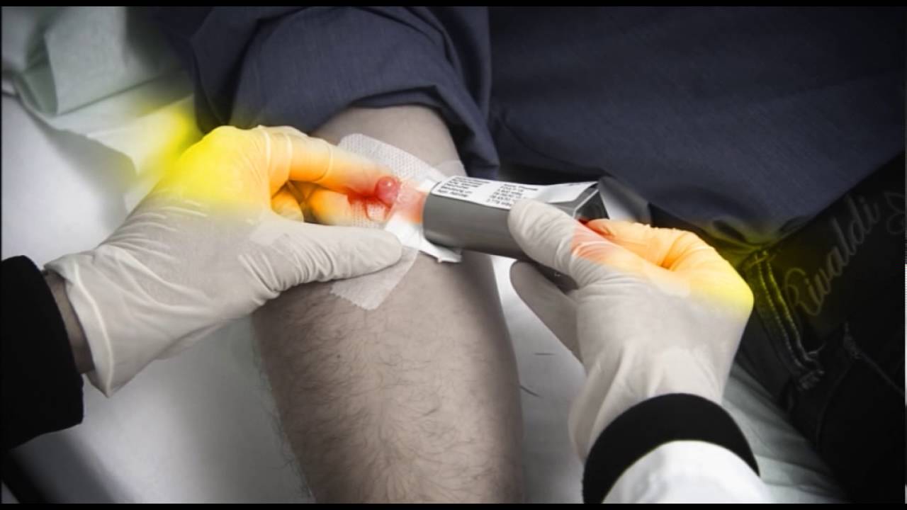 Radioprotection en médecine nucléaire