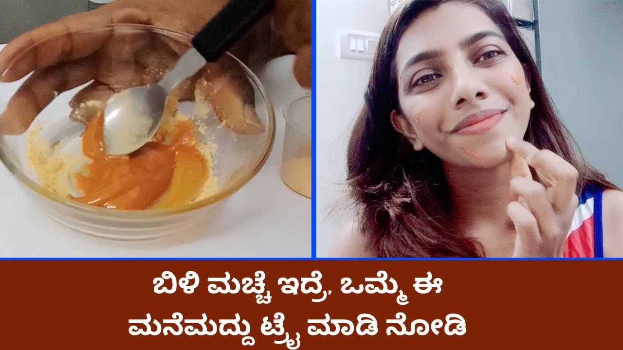 Get Rid Of White Patches By Home Remedy | Vijay Karnataka