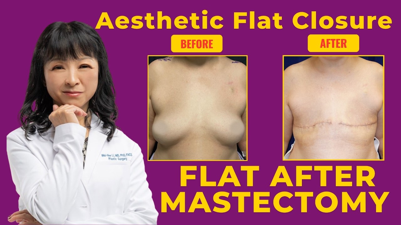 GOING FLAT after mastectomy: Top 5 things you need to know by a plastic surgeon