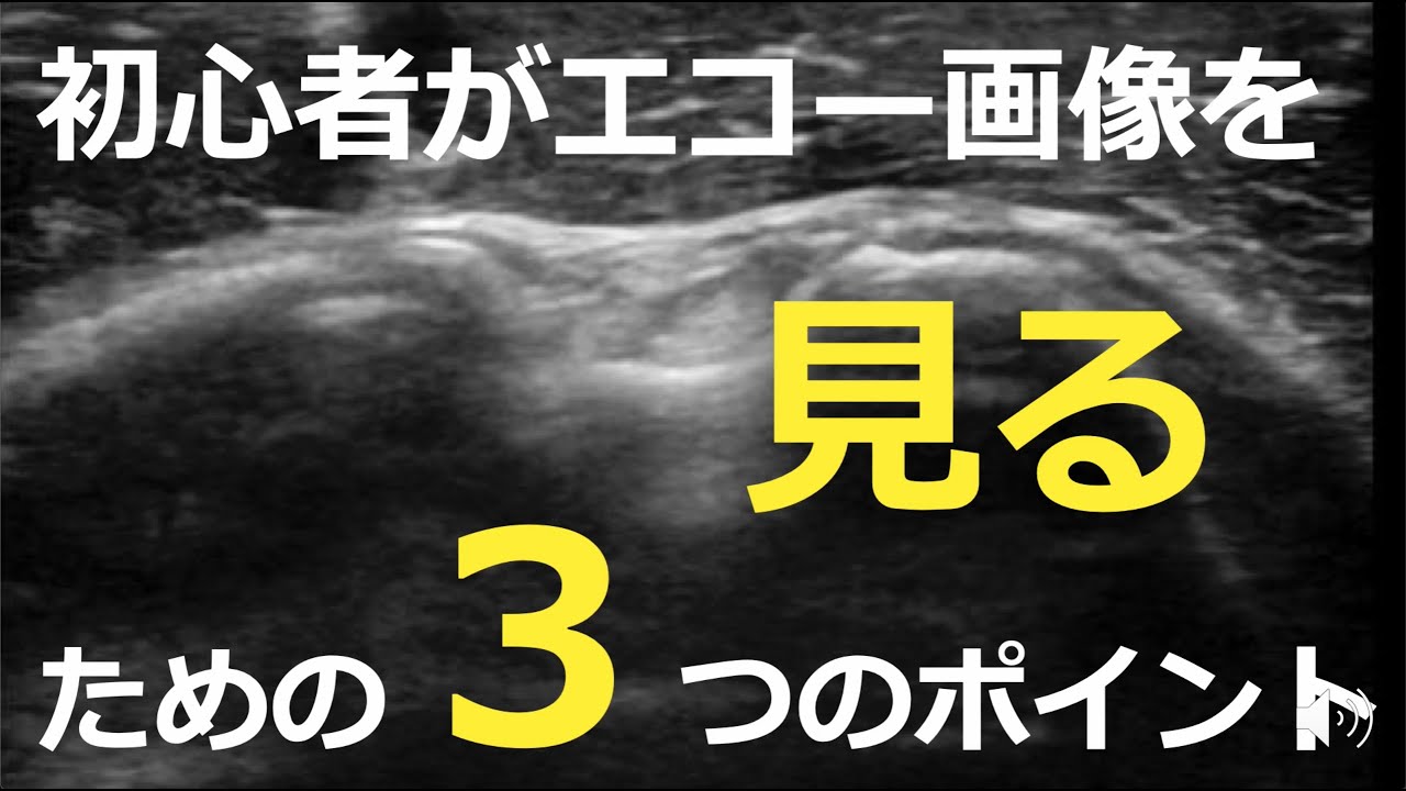 初心者がエコー画像を見るための３つのポイント