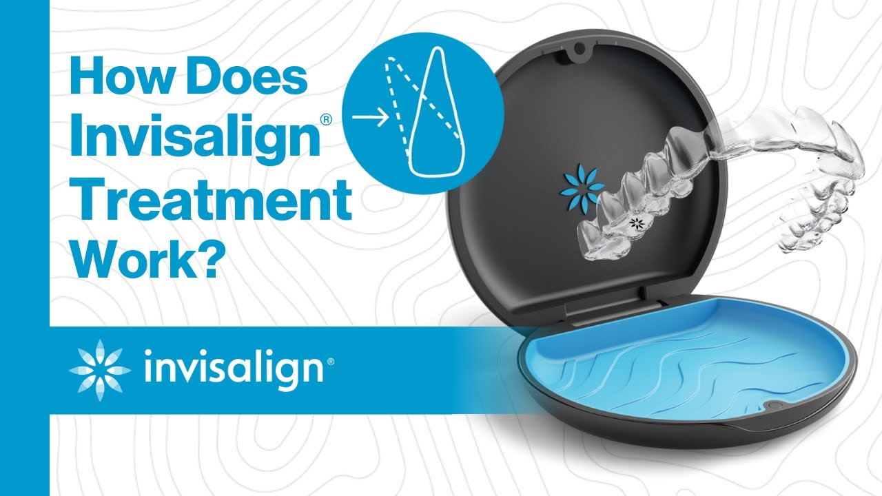 Как работает лечение Invisalign&reg;?