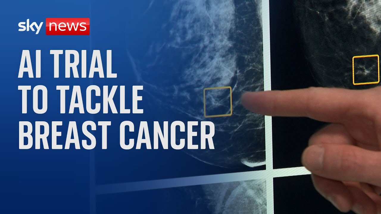 Major breast cancer screening AI trial launched