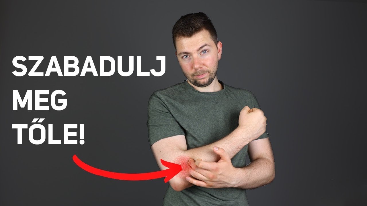 Teniszkönyök gyakorlatok, gyógytorna, okai (Teniszkönyök otthoni kezelése)