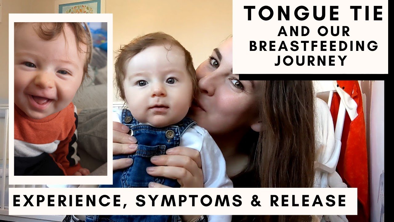 TONGUE TIE * Our Experience, Symptoms, Release and Breastfeeding Journey 💕