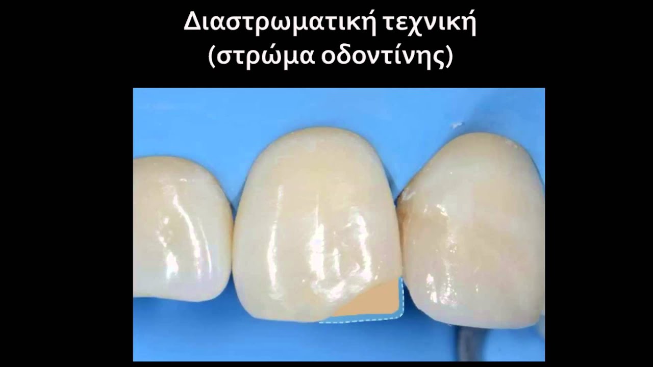 Heraeus Kulzer Dental Science Award 2014-Nektarios Vasilopoulos
